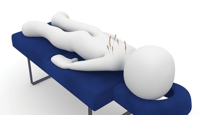 A Guide To Understand Acupuncture Treatment