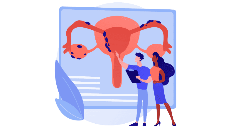 ENDOMETRIOSIS AND ADENOMYOSIS | Find Answers To All Your Questions ENDOMETRIOSIS AND ADENOMYOSIS | Find Answers To All Your Questions
